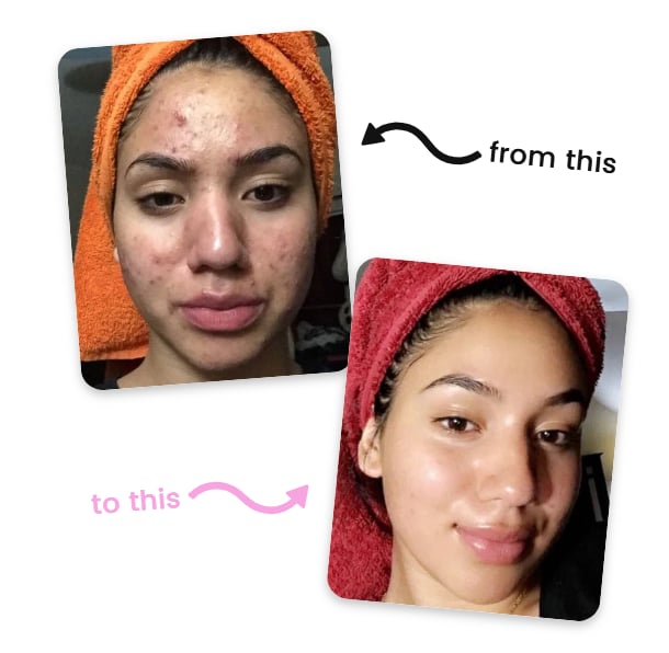 Turmeric and Kojic Acid Bandages